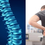 Omurga Kanalında Darlık (Dar Kanal): Yaşla Birlikte Artan Sessiz Tehdit