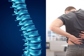 Omurga Kanalında Darlık (Dar Kanal): Yaşla Birlikte Artan Sessiz Tehdit