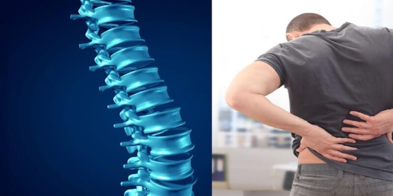 Omurga Kanalında Darlık (Dar Kanal): Yaşla Birlikte Artan Sessiz Tehdit