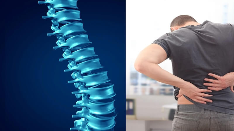 Omurga Kanalında Darlık (Dar Kanal): Yaşla Birlikte Artan Sessiz Tehdit